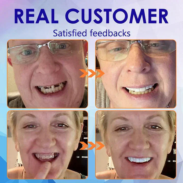 HermsaĀ®-š¦·Advanced Customized Full Denture Set𦷠(ā°Limited time discount last 30 minutesā°)
